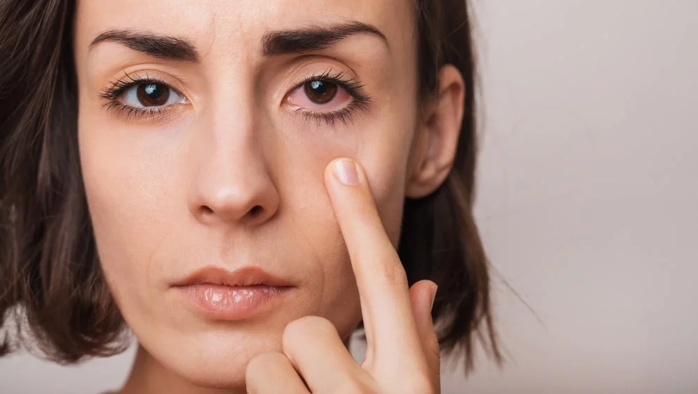 مشکلات چشمی در اثر اشعه آفتاب